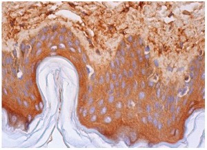 Fibronectin Expression